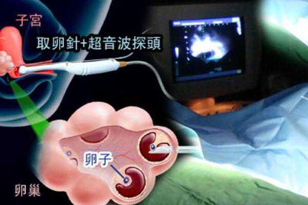 上海供卵代生收费,上海助孕正规机构，上海试管婴儿成功率