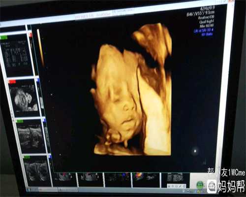 代孕23周胎儿彩超图_泉州医院哪个好