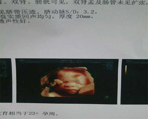 担心长出妊娠纹代孕可参考这几种方法_上海试管