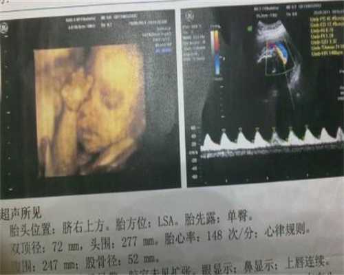 上海代孕女人那里找_365助孕中心