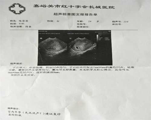 上海代孕公司联系方式_代孕生男孩价格_唐氏筛查