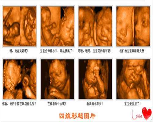 上海世纪助孕服务_找代生孩子女人哪里有_孕后期