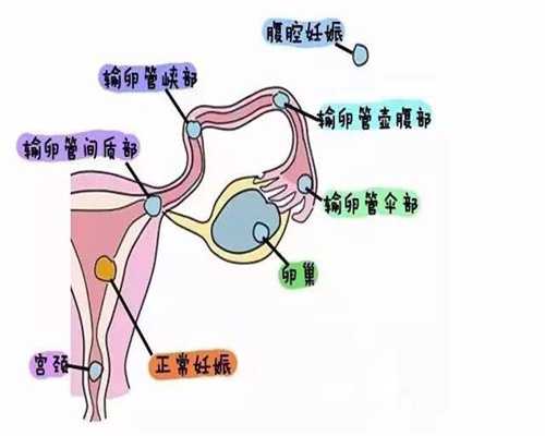 上海世纪供卵机构_海外试管婴儿_怎样会导致胎停