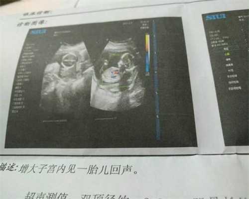 上海个人代孕联系方式_大龄做试管婴儿助孕包成