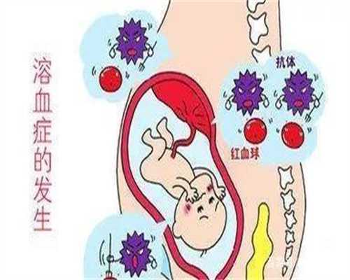 上海世纪代孕怎么联系_代孕机构靠谱吗_