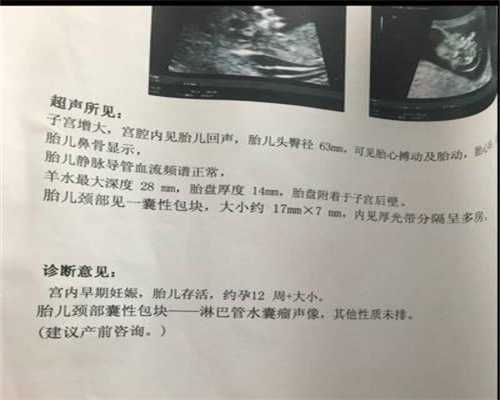 上海代怀孕医生咨询_怀孕5周应该注意什么