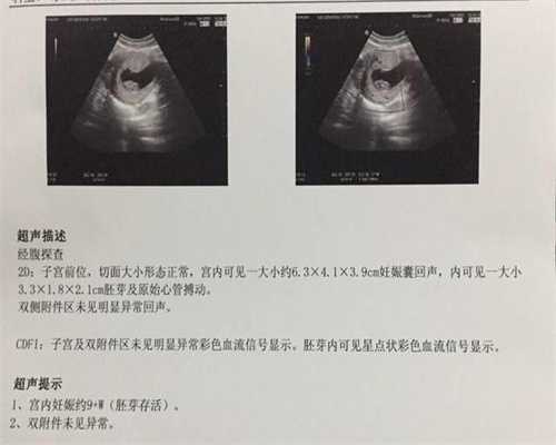 上海代怀孕医生咨询_怀孕5周应该注意什么