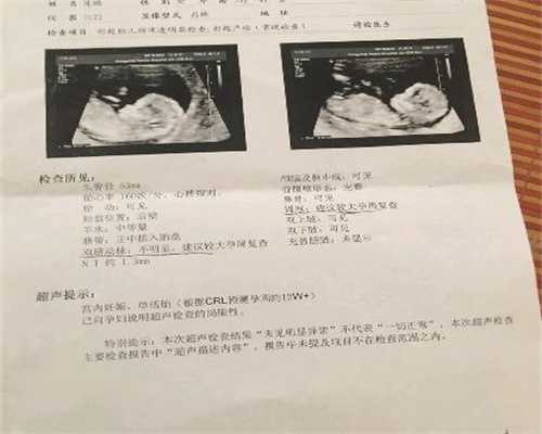 上海找人代生孩子男孩_怀孕8个多月心烧的慌是不
