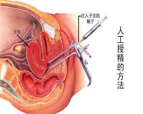 上海代孕需要多少钱能做_上海代孕公司哪家便宜_孕早期腰椎间盘突出会引发流