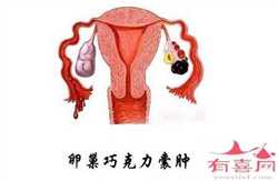 上海代孕生男孩全包价_上海代孕美女_传承国际助孕中心-【37周肚子疼】