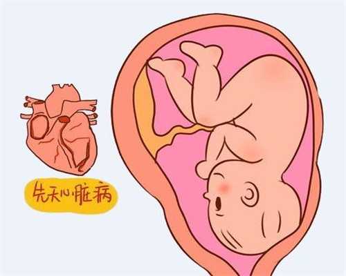 上海助孕包性别多少钱_上海哪个助孕机构好_胎盘剥离有哪些征象
