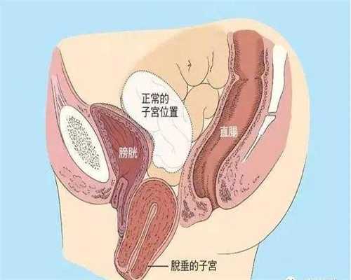 上海专业代怀孕包成功_上海正规排名代怀孕公司_胎盘低置需要注意什么