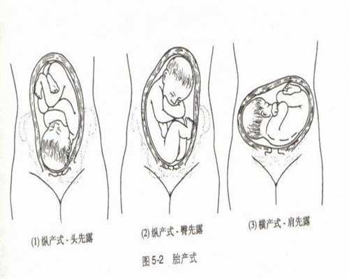 上海哪里有女人代生孩子_上海代生宝宝在线咨询_胎心在右边是什么胎位
