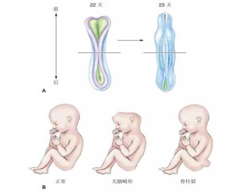 上海代怀孕_上海代怀孕案例_胎位不定是什么意思