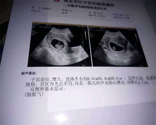 上海供卵捐卵_供卵试管婴儿一般15几万_孕妇放屁多是什么原因