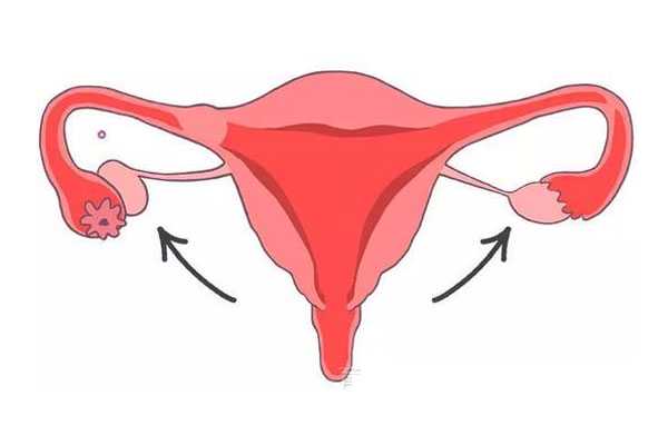 试管移植前准备工作，子宫内膜容受检查符合标准才能移植