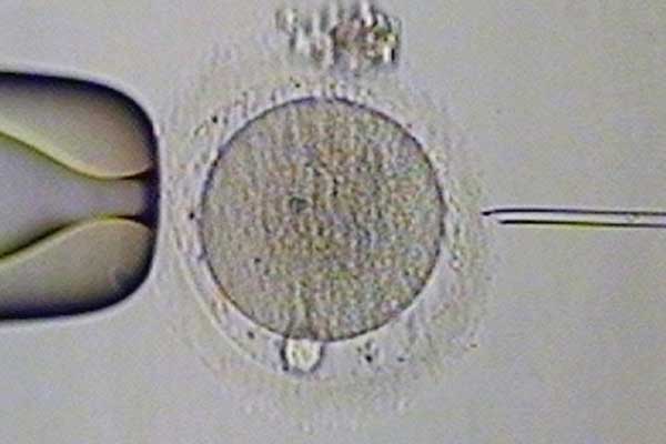 泰国试管婴儿基因检测对囊胚有伤害吗？基因检测有何意义？