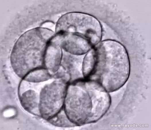 泰国试管婴儿专家告诉你：怎么有效提高胚胎着床率？