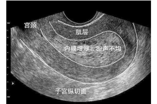 上海试管婴儿移植成功后为什么有些人会不着床，甚至会胎停?